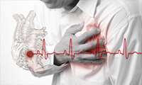 آنچه درباره پیشگیری ازسکته قلبی باید بدانیم 